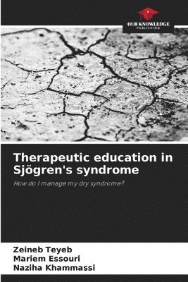 Therapeutic education in Sjgren's syndrome 1