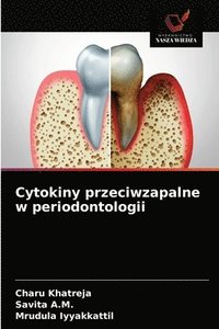 bokomslag Cytokiny przeciwzapalne w periodontologii