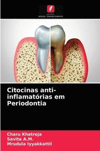 bokomslag Citocinas anti-inflamatrias em Periodontia