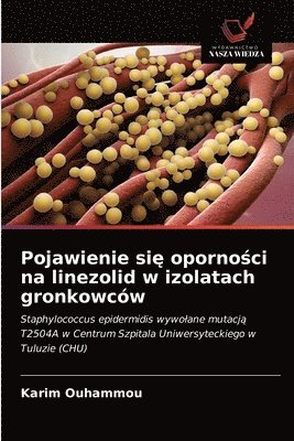 Pojawienie si&#281; oporno&#347;ci na linezolid w izolatach gronkowcw 1