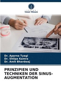 bokomslag Prinzipien Und Techniken Der Sinus-Augmentation