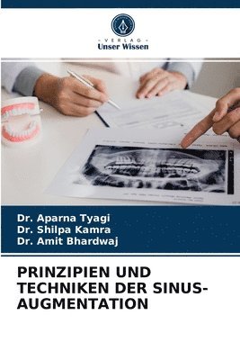 Prinzipien Und Techniken Der Sinus-Augmentation 1