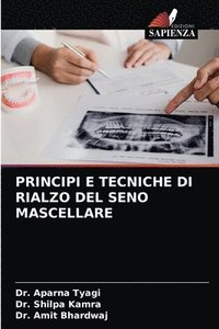 bokomslag Principi E Tecniche Di Rialzo del Seno Mascellare