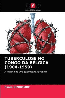 Tuberculose No Congo Da Blgica (1904-1959) 1