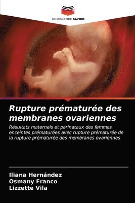 bokomslag Rupture prematuree des membranes ovariennes