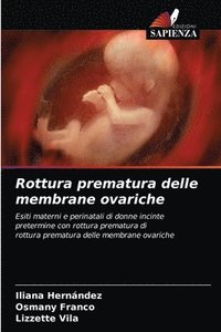 bokomslag Rottura prematura delle membrane ovariche