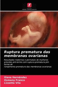 bokomslag Ruptura prematura das membranas ovarianas
