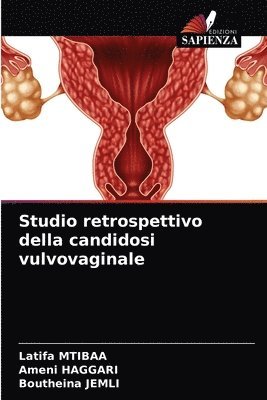 Studio retrospettivo della candidosi vulvovaginale 1