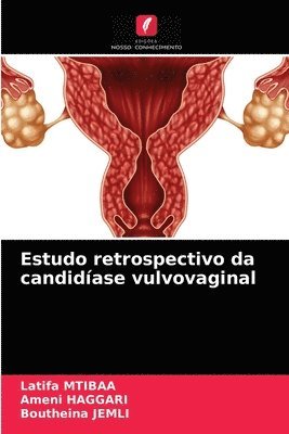 Estudo retrospectivo da candidase vulvovaginal 1