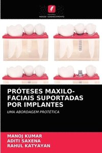 bokomslag Prteses Maxilo-Faciais Suportadas Por Implantes