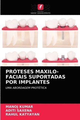 Prteses Maxilo-Faciais Suportadas Por Implantes 1