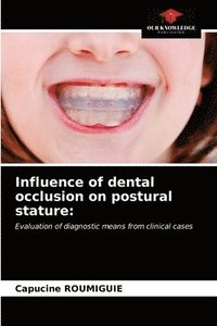 bokomslag Influence of dental occlusion on postural stature