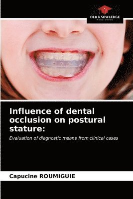 Influence of dental occlusion on postural stature 1