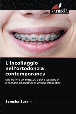 L'incollaggio nell'ortodonzia contemporanea 1