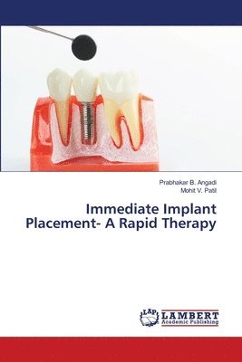 bokomslag Immediate Implant Placement- A Rapid Therapy