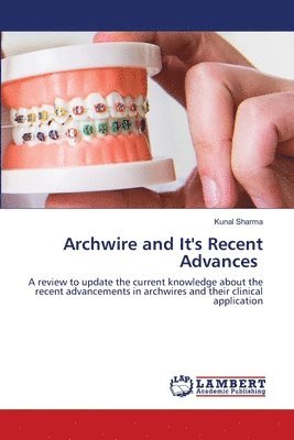 Archwire and It's Recent Advances 1