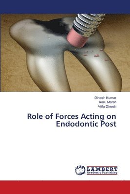 Role of Forces Acting on Endodontic Post 1