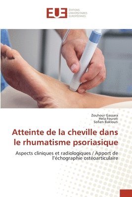 bokomslag Atteinte de la cheville dans le rhumatisme psoriasique
