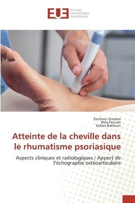 Atteinte de la cheville dans le rhumatisme psoriasique 1