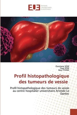 Profil histopathologique des tumeurs de vessie 1