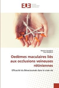 bokomslag Oedmes maculaires lis aux occlusions veineuses rtiniennes