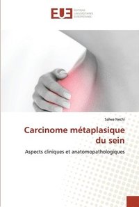 bokomslag Carcinome mtaplasique du sein