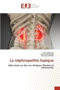 bokomslag La nphropathie lupique
