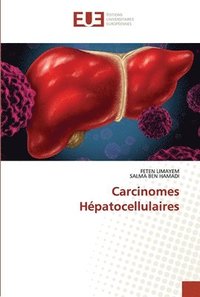 bokomslag Carcinomes Hpatocellulaires