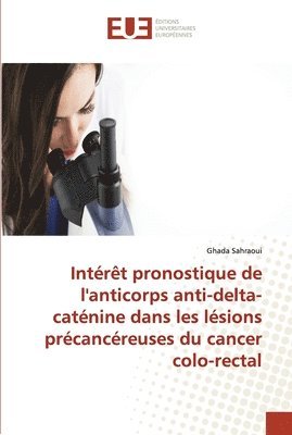Intrt pronostique de l'anticorps anti-delta-catnine dans les lsions prcancreuses du cancer colo-rectal 1