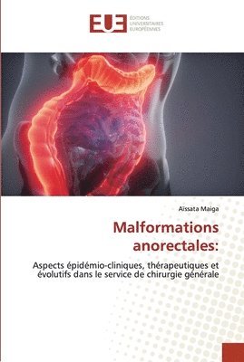 Malformations anorectales 1