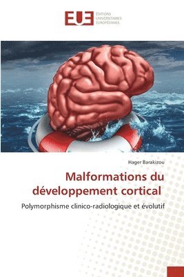 Malformations du dveloppement cortical 1