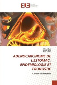 bokomslag Adenocarcinome de l'Estomac