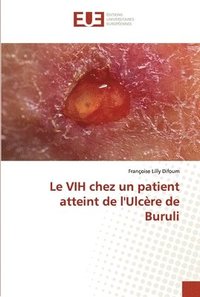 bokomslag Le VIH chez un patient atteint de l'Ulcre de Buruli