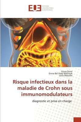 Risque infectieux dans la maladie de Crohn sous immunomodulateurs 1