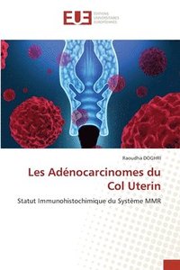 bokomslag Les Adnocarcinomes du Col Uterin