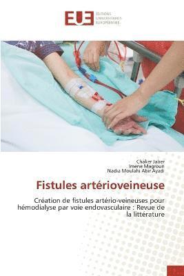 Fistules artrioveineuse 1
