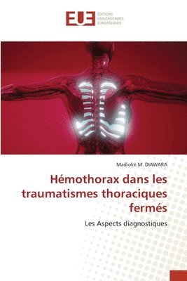 bokomslag Hmothorax dans les traumatismes thoraciques ferms