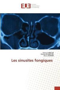 bokomslag Les sinusites fongiques
