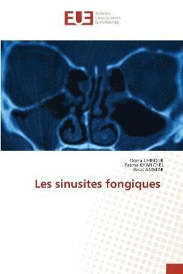 bokomslag Les sinusites fongiques