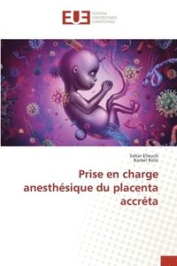 bokomslag Prise en charge anesthsique du placenta accrta