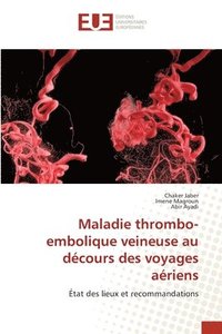 bokomslag Maladie thrombo-embolique veineuse au dcours des voyages ariens