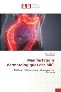 bokomslag Manifestations dermatologiques des MICI