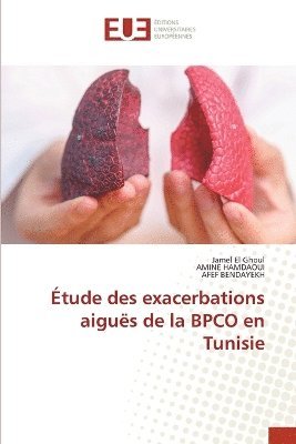 bokomslag Étude des exacerbations aiguës de la BPCO en Tunisie