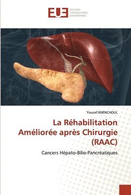 La Rhabilitation Amliore aprs Chirurgie (RAAC) 1