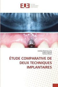 bokomslag tude Comparative de Deux Techniques Implantaires