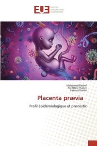 bokomslag Placenta prvia