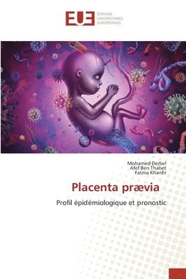 Placenta prvia 1