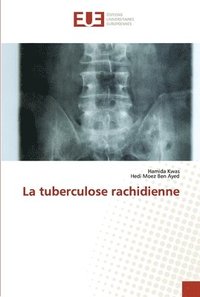 bokomslag La tuberculose rachidienne