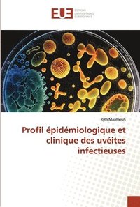 bokomslag Profil pidmiologique et clinique des uvites infectieuses