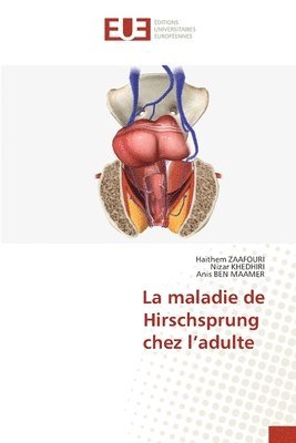 bokomslag La maladie de Hirschsprung chez l'adulte